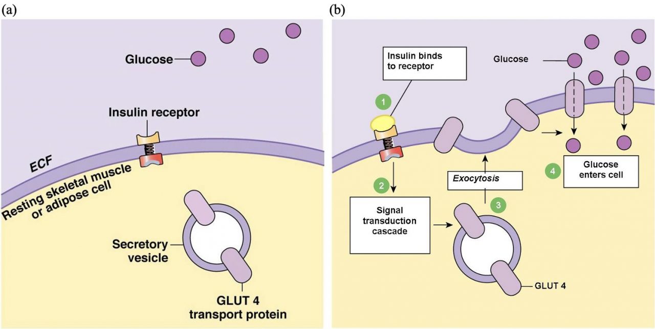 How Insulin Resistance Leads To Type 2 Diabetes - Reversing T2D